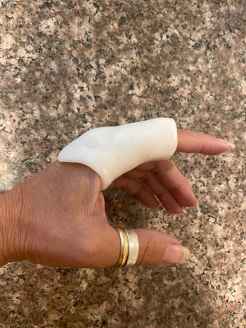 reviewer with a large white plastic splint on their index finger