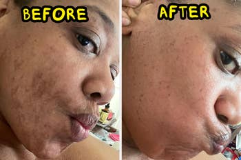 person earlier  and aft  utilizing buf puf sponge