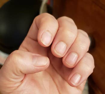 the same reviewer's nails looking healthier after using the product