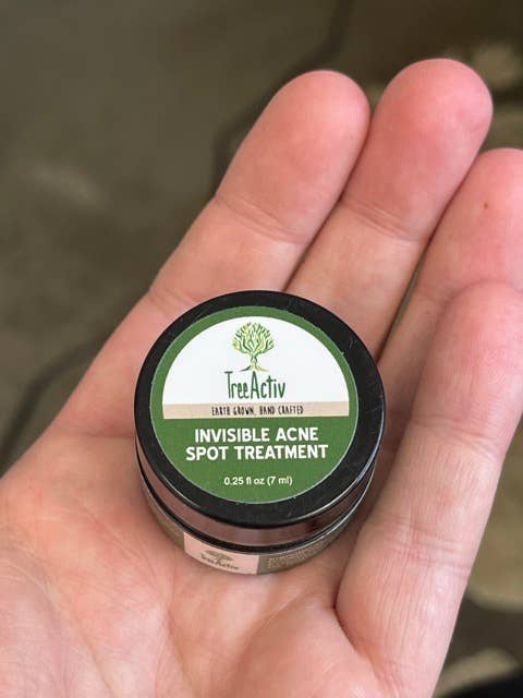 image of the spot treatment container in the palm of a reviewer's hand