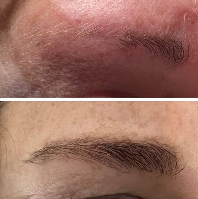 reviewer's eyebrow before and after using serum with noticeable growth