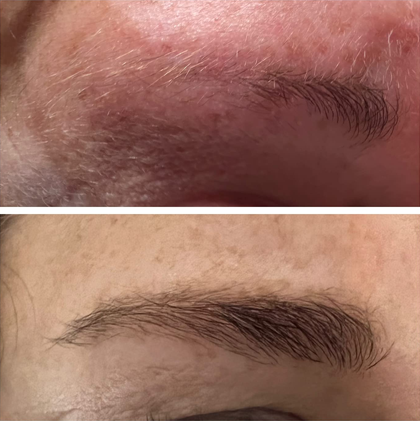 reviewer's eyebrow before and after using serum with noticeable growth