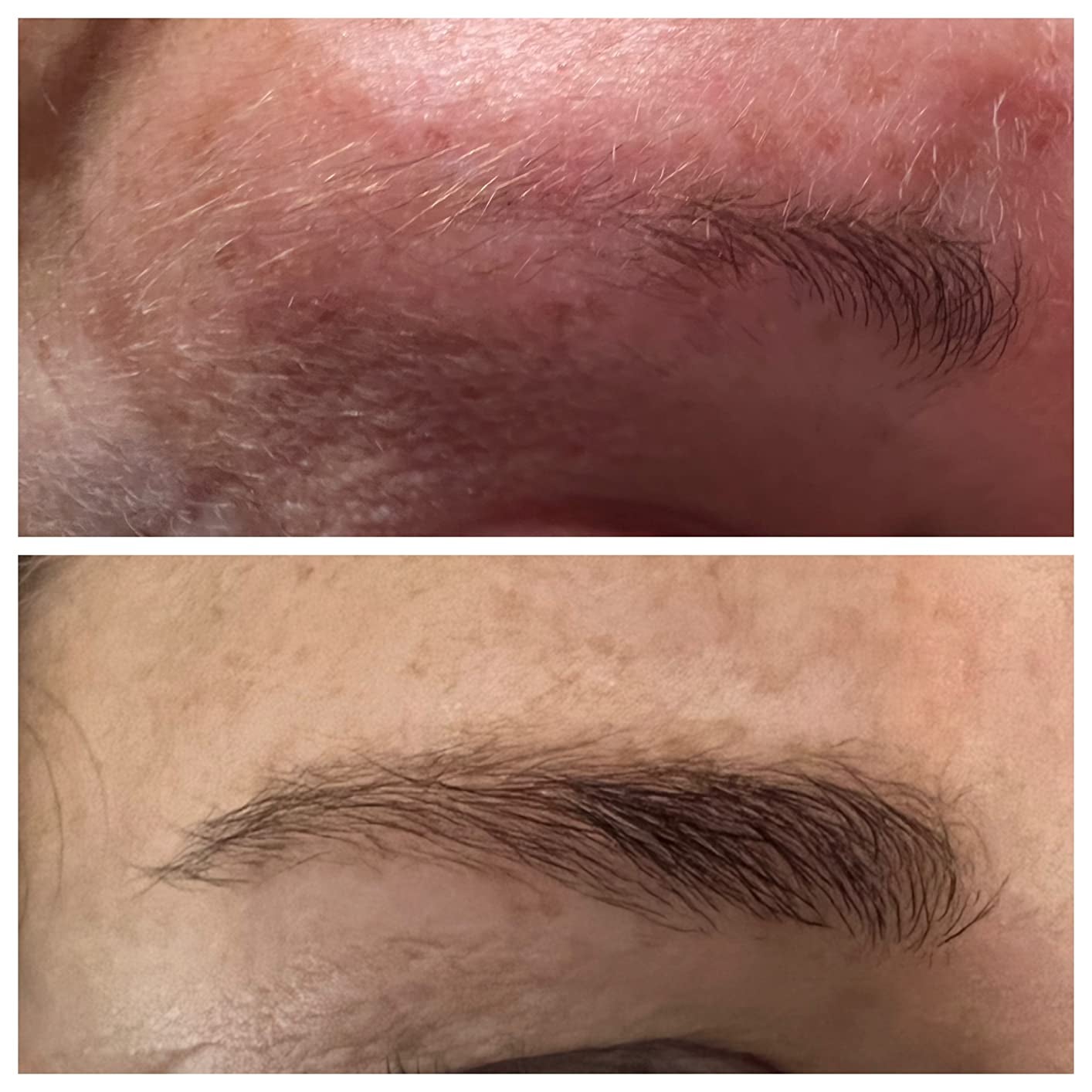 reviewer's eyebrow before and after using serum with noticeable growth