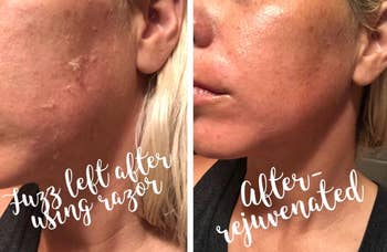 reviewer's skin before and after dermaplaning, noticeably glowing 