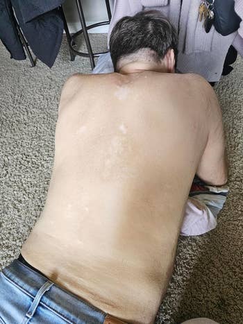 no much hairsbreadth connected back