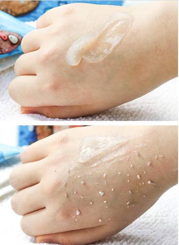Before and after pic of a hand with gel on it, and dry skin peeling off the hand 