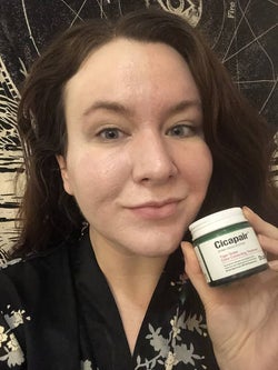 Buzzfeed editor with cicaplast cream on half her face, reducing redness, holding up the container