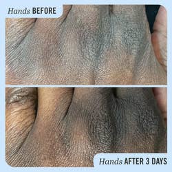 A before and after of the model using the cream on their knuckles that look more hydrated after