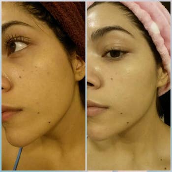 A reviewer's before and after photo with clear, glowy skin