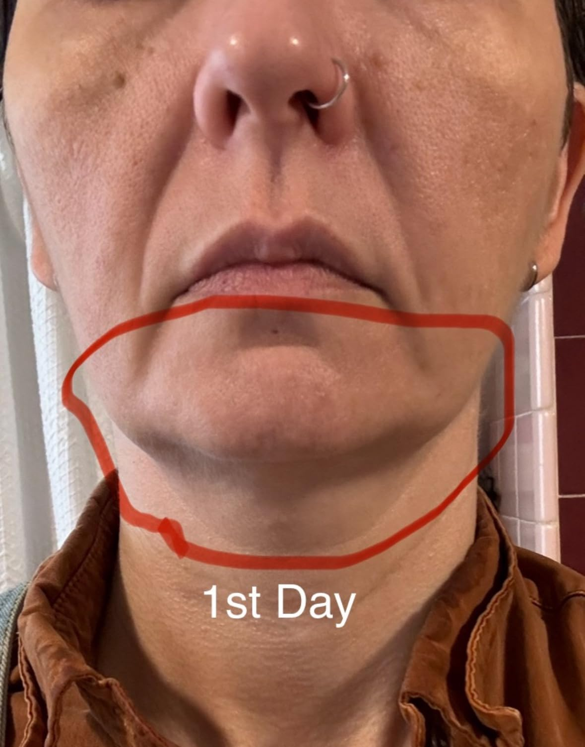 Close-up of a person’s jawline circled in red with text 