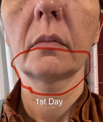 Close-up of a person’s jawline circled in red with text