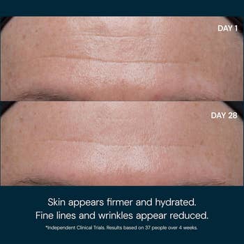 Comparison of a forehead's tegument  connected  Day 1 and Day 28, showing reduced good  lines and wrinkles, with substance   highlighting objective  improvement
