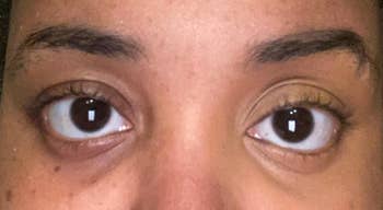 Reviewer with left eye without the product having a darker undereye circle and the right eye withe the product looking more brightened