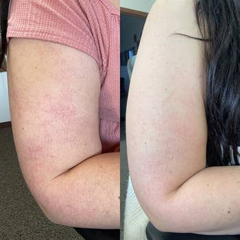 different reviewer's arm before and after using scrub