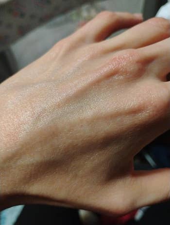 Close-up of a hand, showcasing skin texture and appearance. Likely emphasizing skincare or health