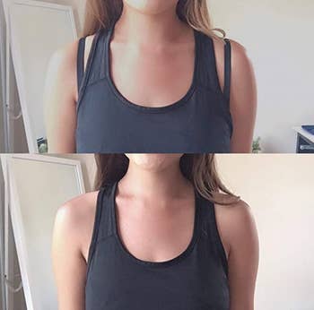 person before and after using razor bra strap clips on bra under a tank top