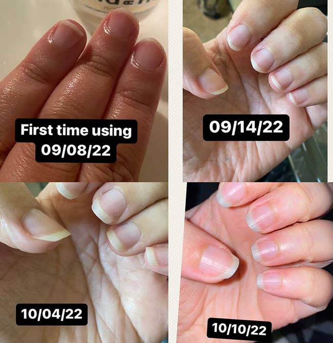 series of photos showing a reviewer's nails looking longer after using the strengthening cream