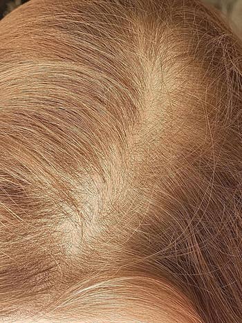 Close-up of hair roots showing scalp detail, highlighting hair texture and growth, possibly for a hair care or beauty products article
