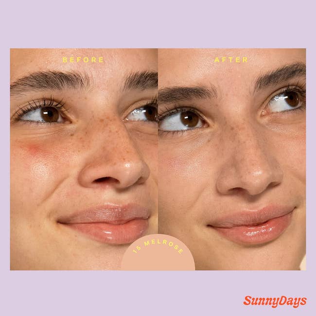 model before and after applying the tinted moisturizer showing it covered redness on their cheeks and around their nose