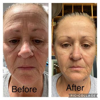another reviewer's skin before and after using skin tightening cream with tighter skin