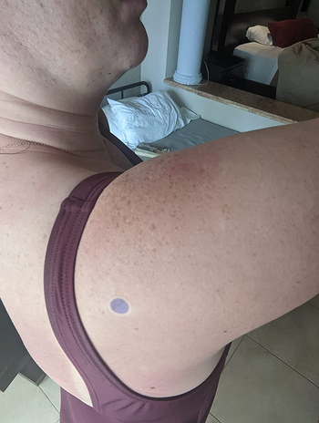 Reviewer with purple sticker on their arm 