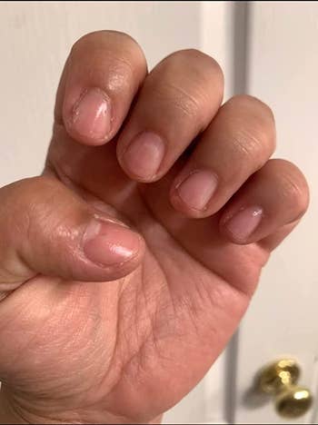 A reviewer's before photo showcasing their short nails 