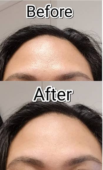 reviewer before and after photos showing their forehead looking shiny above a photo of their forehead looking more matte after using the face roller