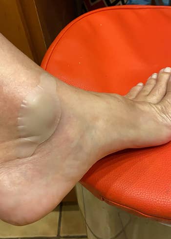 A transparent blister bandage on a reviewer's ankle 