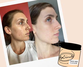 a model before and after for the face mask