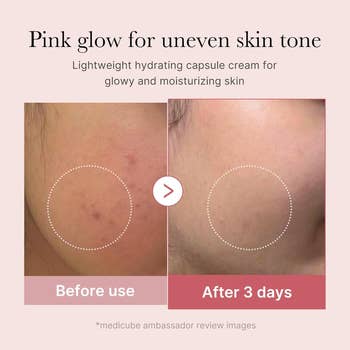 Before-and-after examination of tegument utilizing hydrating capsule pick for glowy, moisturized results successful 3 days