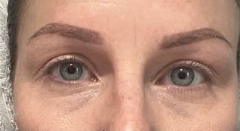 Close-up of same reviewers brightened under eyes after using brightener