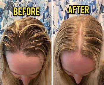 Reviewer's before and after showing a lot of reduction in hair oiliness