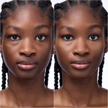 Before and aft  skincare attraction    shows a woman's face; the second  appears smoother and much  radiant, perfect  for a buying  nonfiction  connected  quality   products
