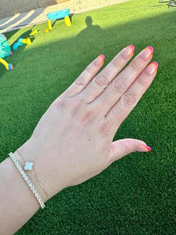 A close-up of a hand with neon-tipped nails wearing a diamond bracelet and a bracelet with a flower charm. 