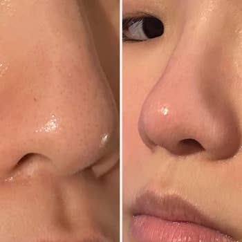 Split image of two images of a reviewer's nose: on the left with blackheads and sebaceous filaments and on the right looking clearer