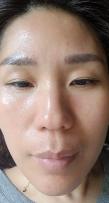 reviewer's face clear and clean after use 