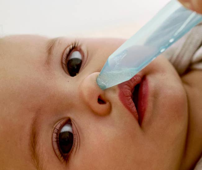 A baby's nose being suctioned with a bulb syringe to clear nasal congestion