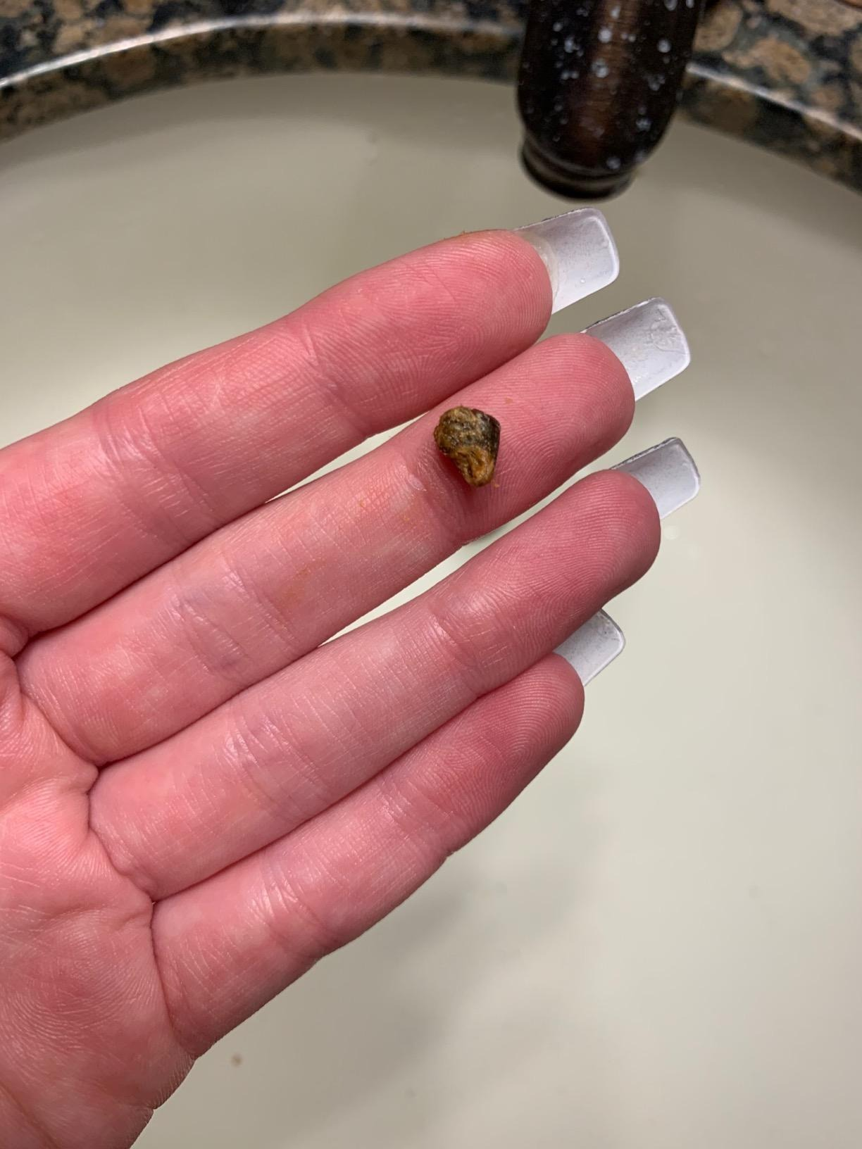 Post image 10