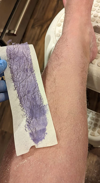 same reviewer's leg with one patch of skin without hair, reviewer is holding wax strip with purple wax and hair on it