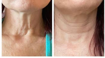 Reviewer's neck before and after using neck cream