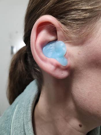 Custom-fitted blue earplug in a person's ear, designed for comfort and noise reduction