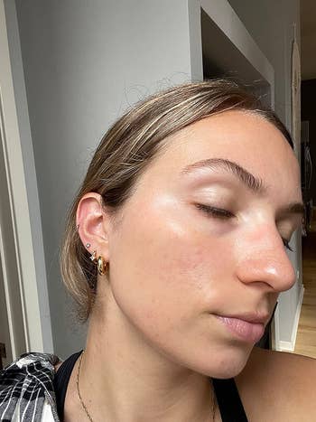 the aforesaid  reviewer showing their aft  and however  the balm has neutralized their reddish  spots