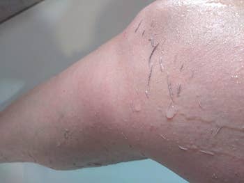 A reviewers leg with bits of exfoliated skin removed with the exfoliating washcloth
