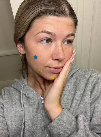 reviewer with blue and yellow star shaped pimple patches on their face