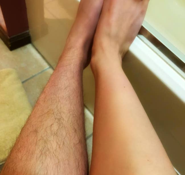 reviewer photo of one leg covered with hair and the other hair-free