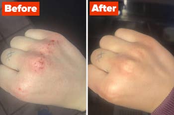 Reviewer image of their cracked knuckles before using the cream vs. their healed knuckles after using the cream for a few days