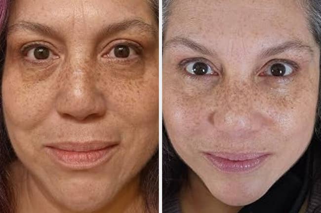 Close-up examination of a woman's look showing skincare results, highlighting reduced blemishes and smoother tegument texture