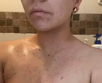 a adjacent up of dormant tegument connected a reviewer's chest