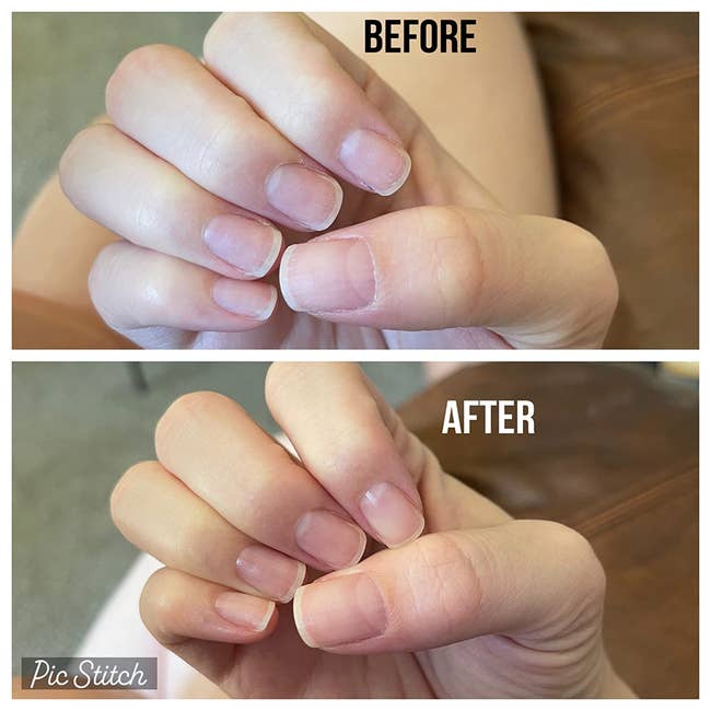 Close-up of a person's fingernails shown earlier and after, highlighting the improved information and appearance