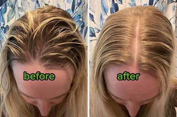 left: reviewer before photo of stringy, greasy roots / bottom: after using I Dew, roots are full, voluminous and no signs of grease